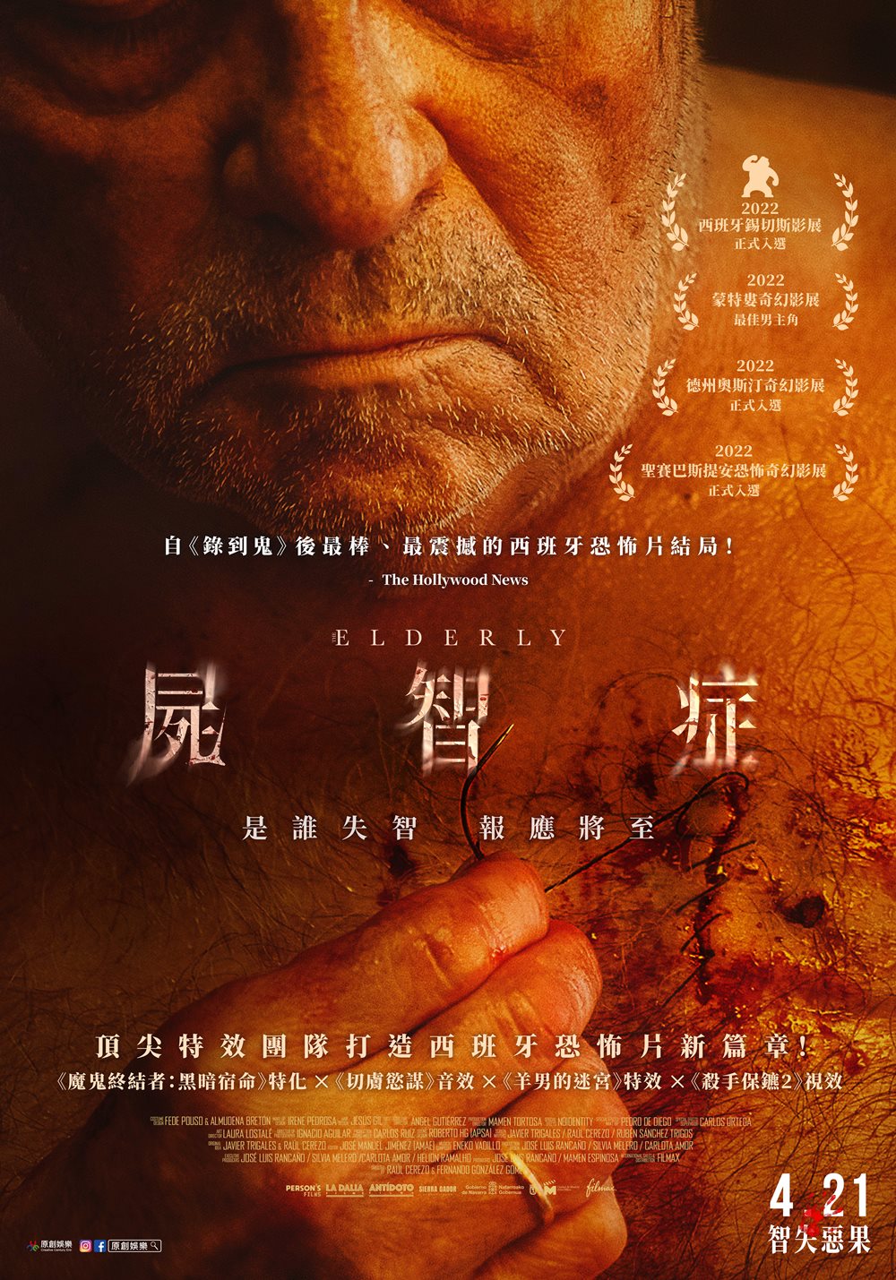 屍智症 屍智症